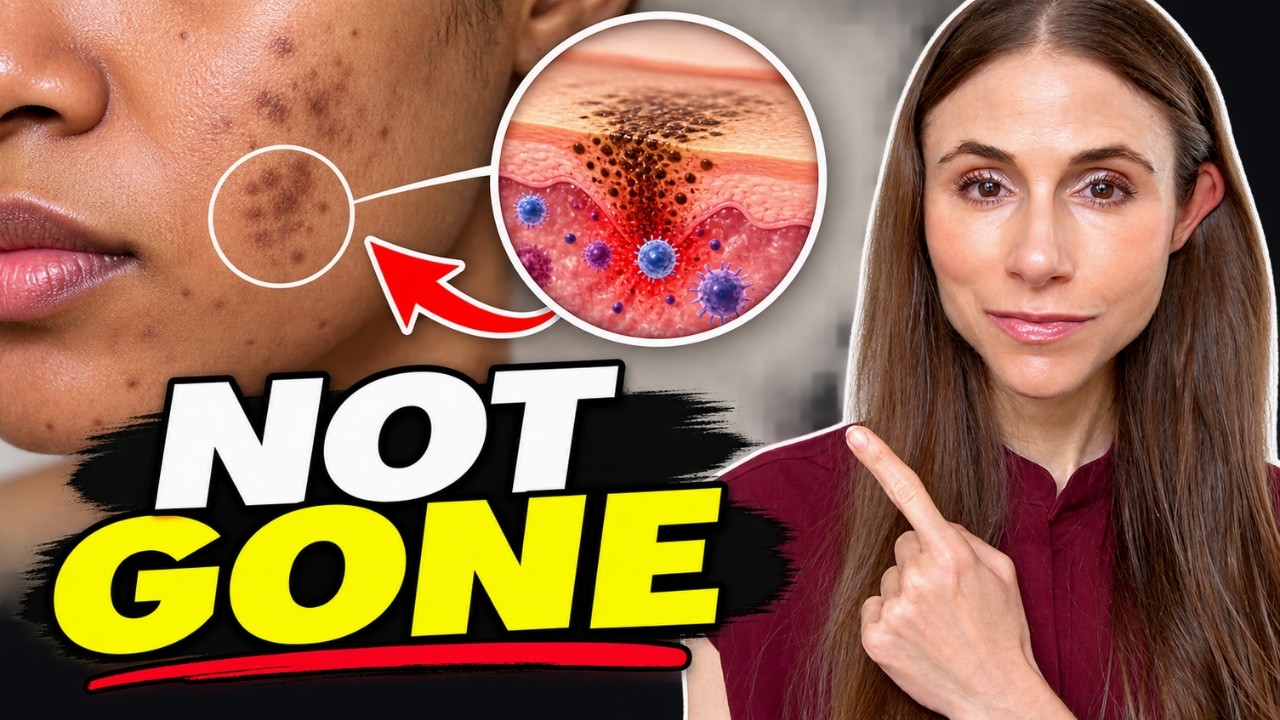 Why Your Hyperpigmentation Won’t Go Away | Dermatologist Explains — Dr Dray