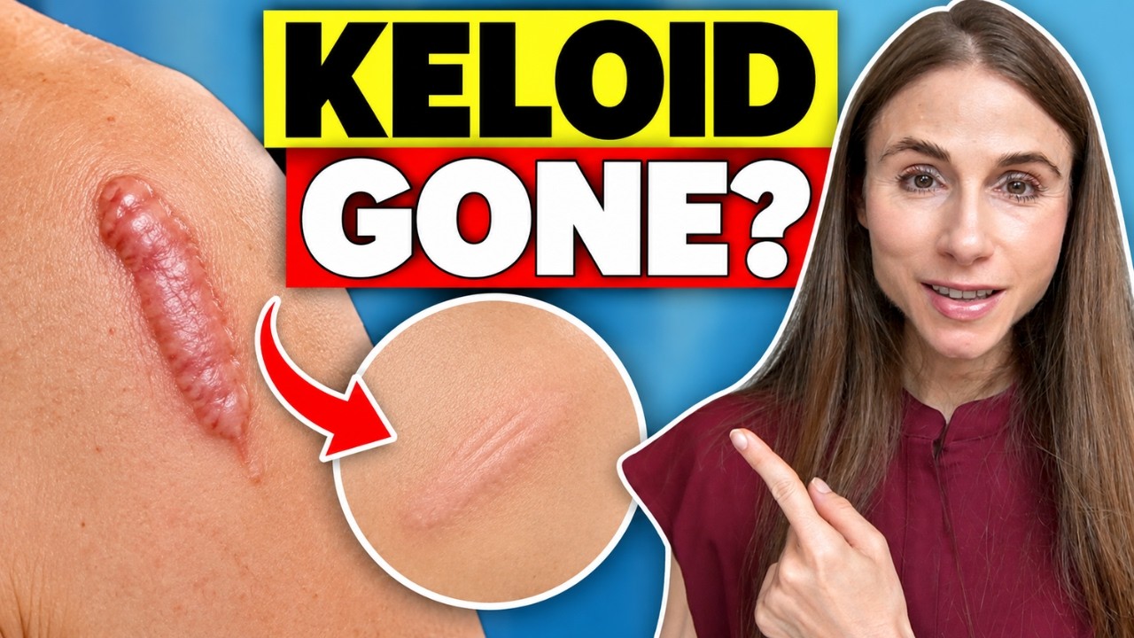 Can Keloid Scars Be Removed? Dermatologist Q&A — Dr Dray