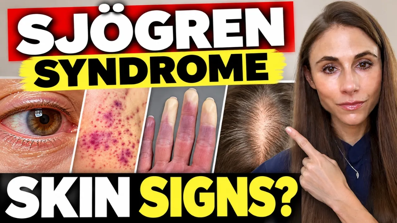 Sjögren Syndrome: Skin Symptoms, Rashes & Hair Loss | Dermatologist Explains — Dr Dray