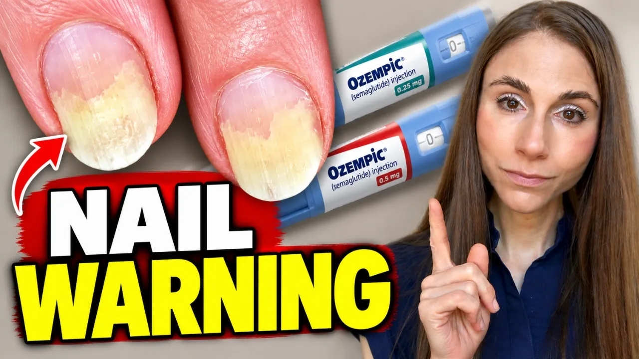 GLP-1s & Nail Detachment? New Study Reveals a Surprising Side Effect — Dr Dray
